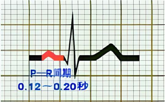 短pr间期一般寿命多久