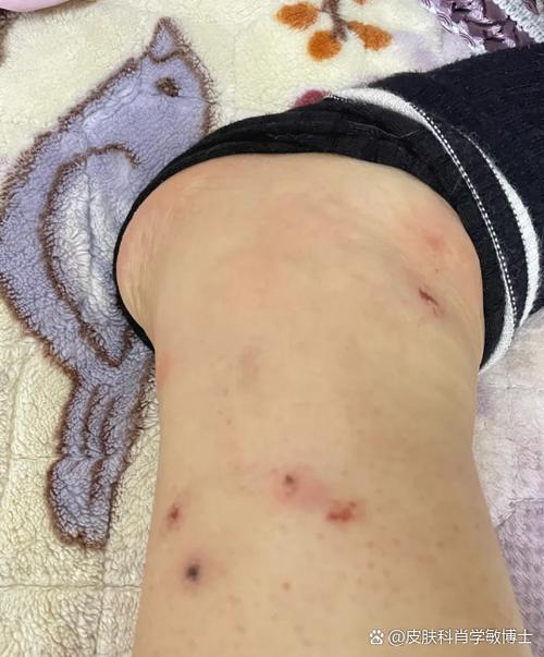 被挠痒痒的后果