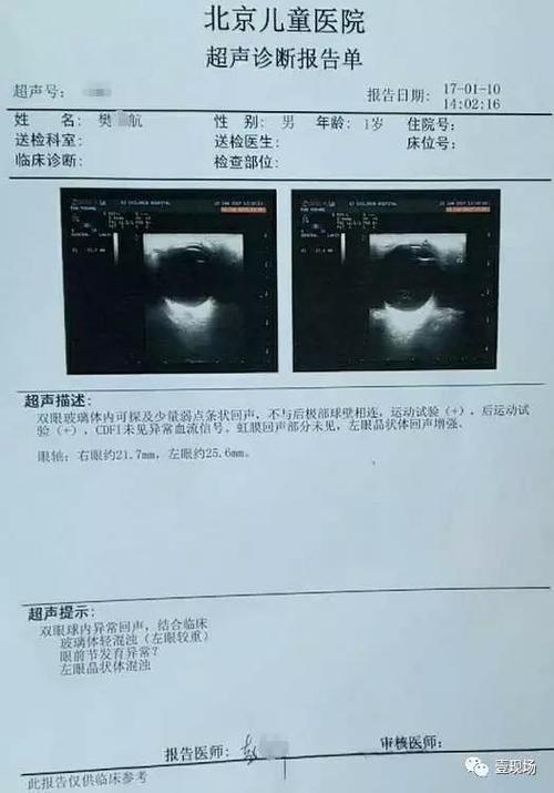 打电话有自己的回音怎么回事