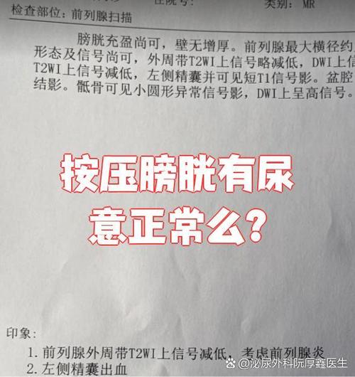 为什么挤压膀胱会有尿意