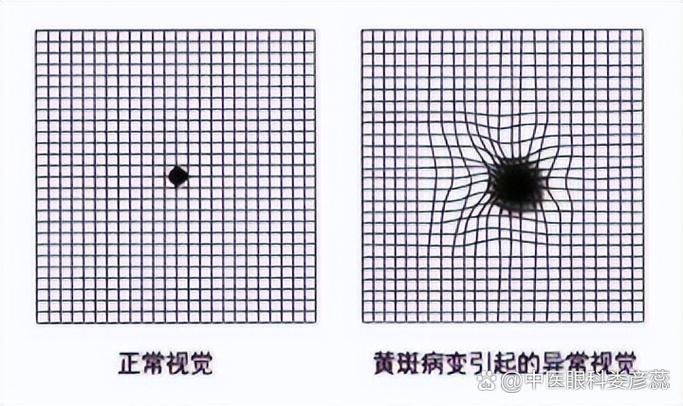 手机屏幕黄斑怎么恢复