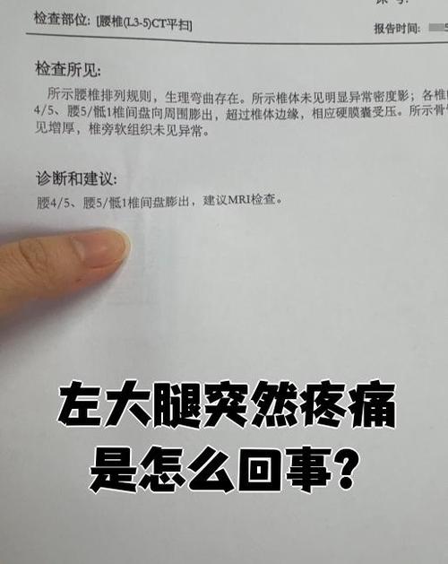 女人左腿疼痛位置图游戏截图