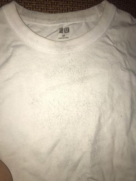 白衣服顽固黄渍斑