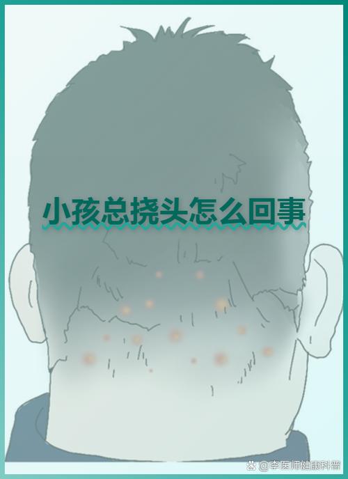 婴儿频繁挠头痒要警惕游戏截图