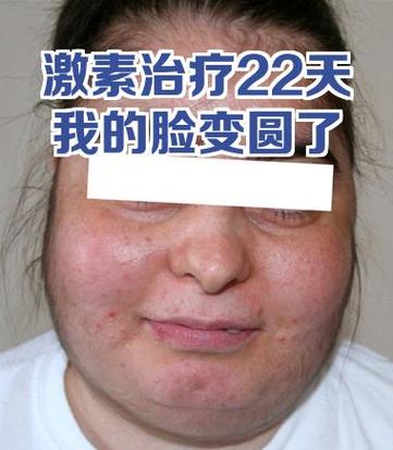 怎样可以让脸变圆图标