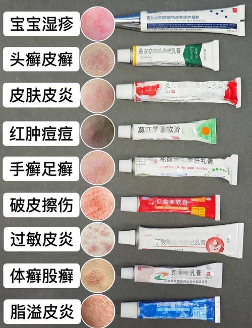 湿疹涂了生长因子涂了三天