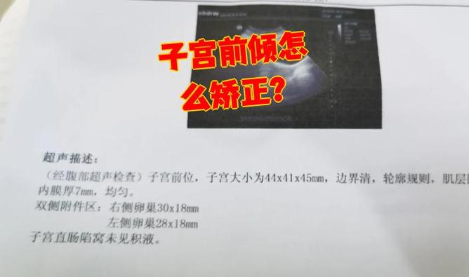 子宫67x62x63偏大吗