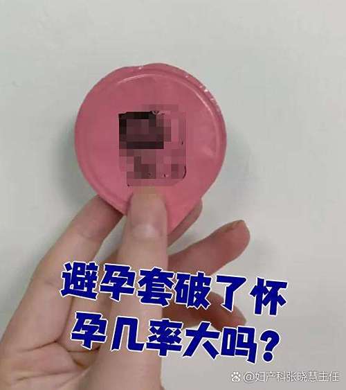 避孕套用多了会影响生育吗