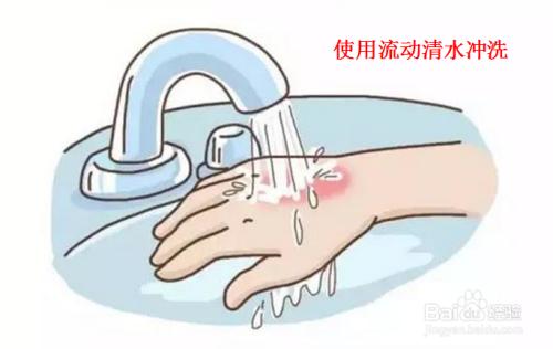 实验室浓硫酸溅到皮肤上怎么办截图