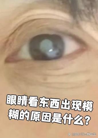 越近越看不清楚东西是什么眼病