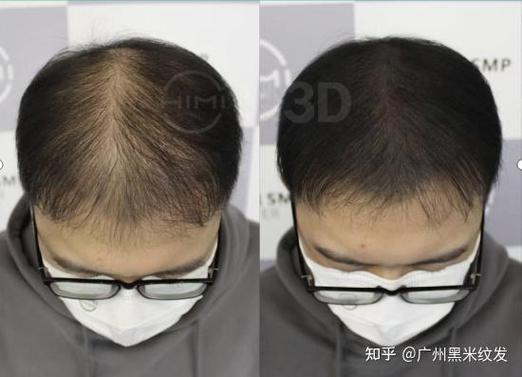 3d纹发多少钱
