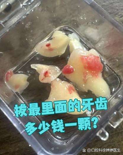 拔虎牙多少钱一颗啊截图