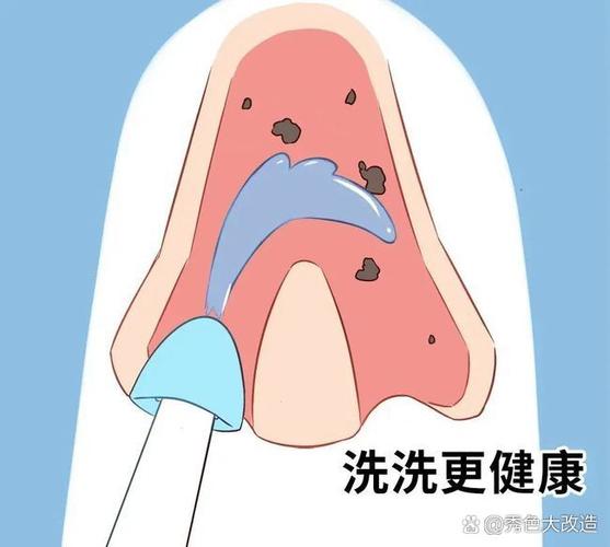 米粒呛到鼻腔2天会有反应吗