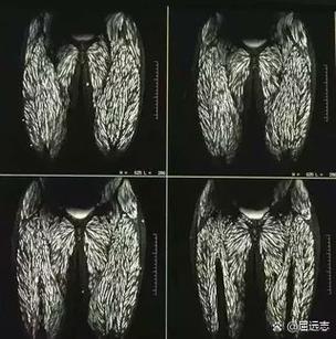 全身长满寄生虫视频