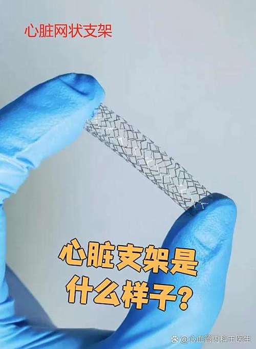 心脏支架怕磁铁吗