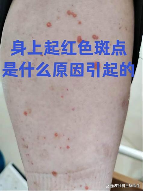 斑点越来越多什么原因