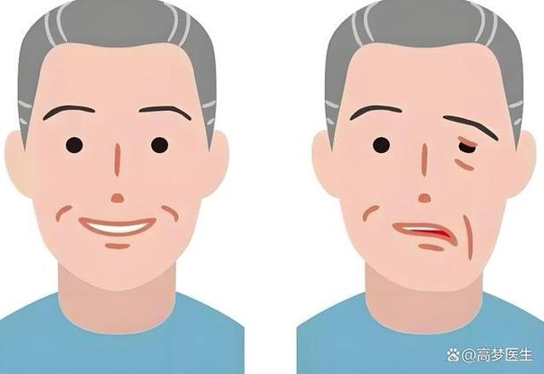 脸部下颌线打伤多久能好缩略图