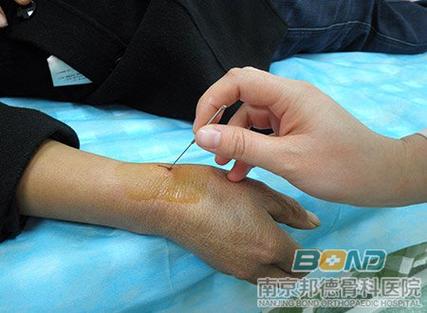 小针刀四大害处截图