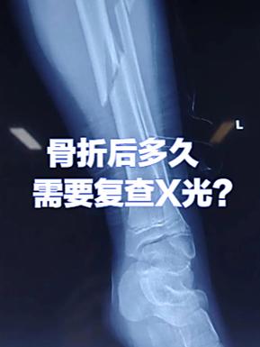 去医院拍片子流程