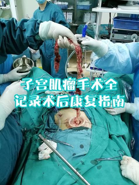 44岁柳岩自曝患子宫肌瘤能治吗截图