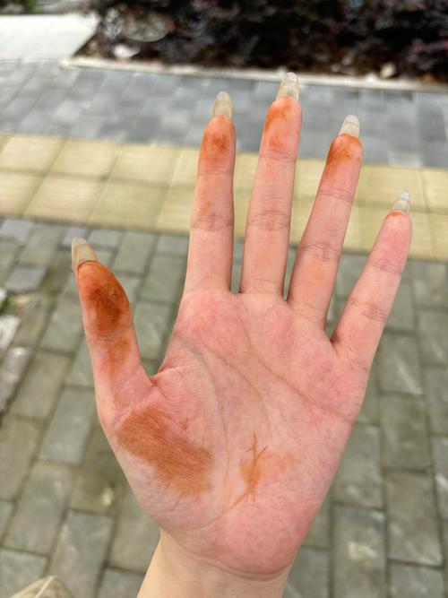 手突然有铁锈一样的黄