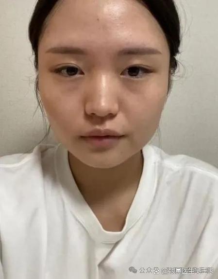 如何逆袭改变容貌
