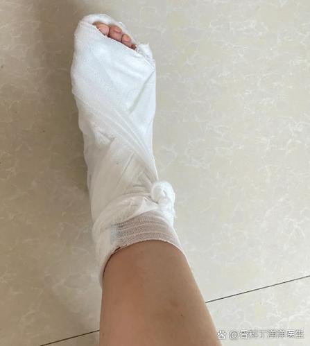 脚趾头骨折用脚后跟走路图标