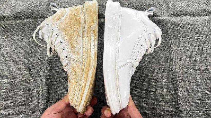 小白鞋发黄怎么处理能变白