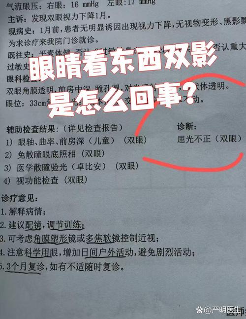 眼睛看见双影是什么问题