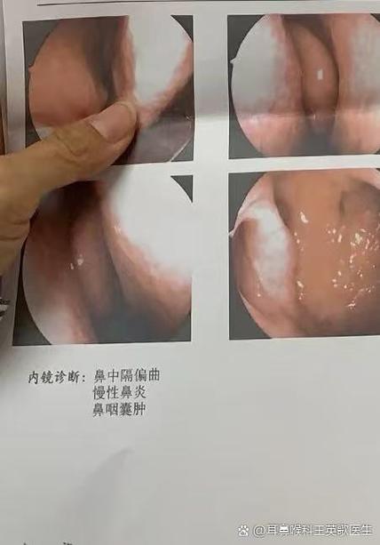 流鼻血是什么原因造成的游戏截图