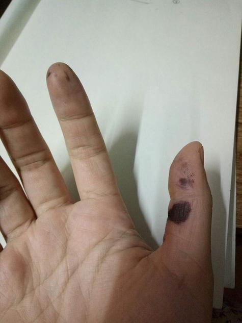 手上的笔水怎么去除截图