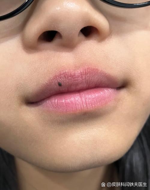 男生嘴唇粉红色正常吗
