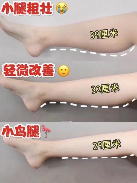 腿细怎么变粗增加肌肉缩略图