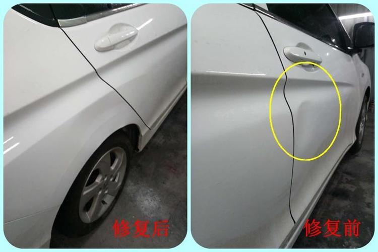 太阳穴凹陷做什么医美