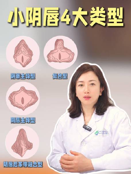 阴部各种形状的图片及名称百度百科
