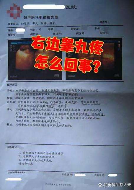 右边睾丸一抽一抽的疼