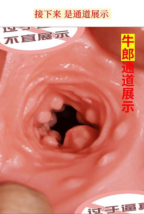 阳器端