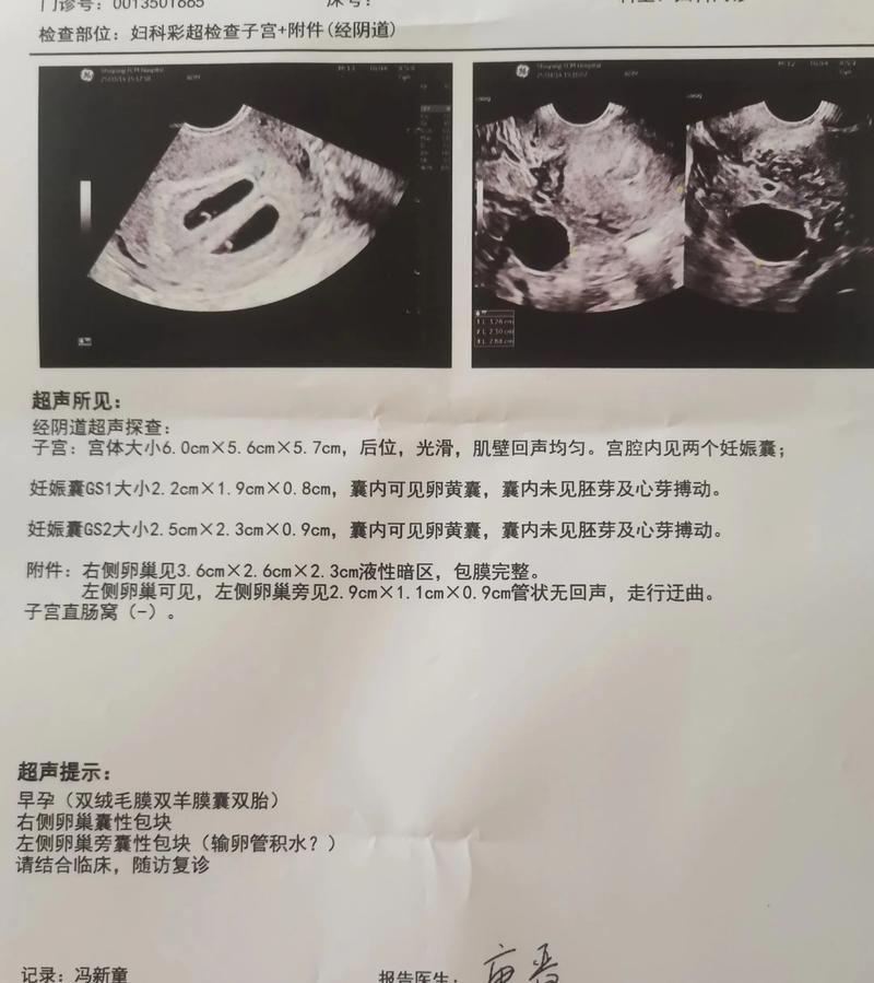 女胎答一字