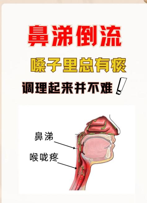 痰和鼻涕黄绿色怎么回事