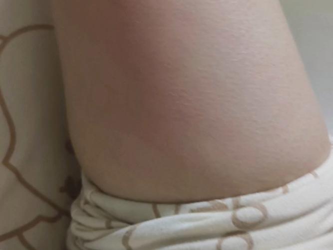 腿抽