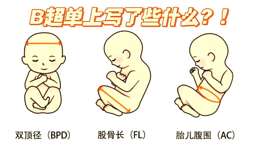 双顶径股骨长看男女技巧