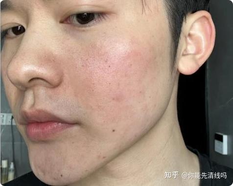 下水道油脂硬化结块图标