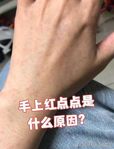 手机顶部有红点要警惕