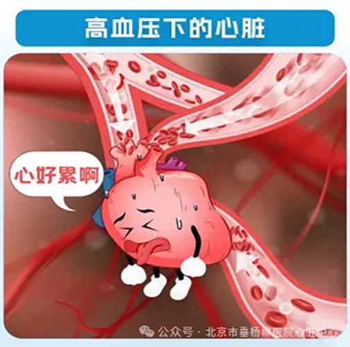 心脏高压严重吗图标