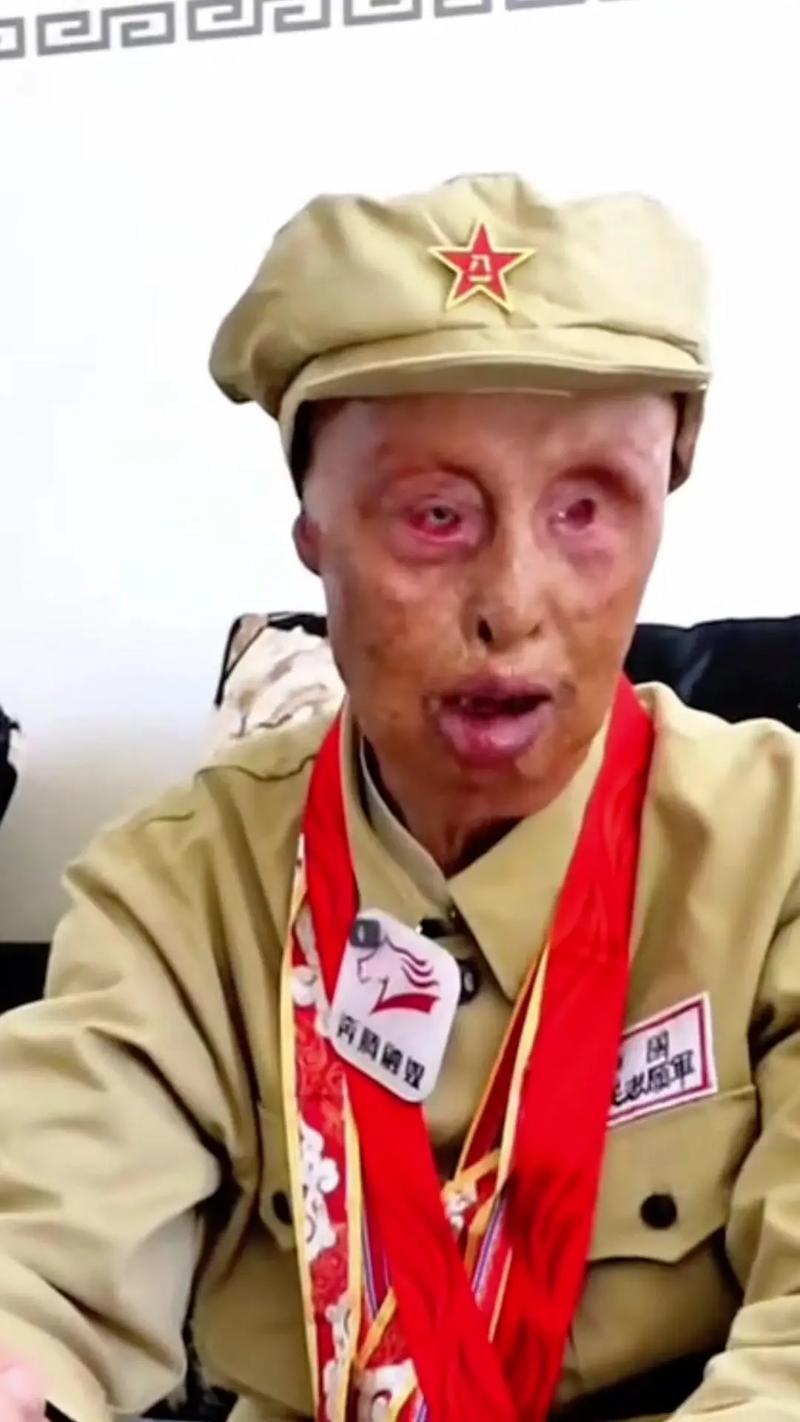英雄联盟最肉的英雄缩略图
