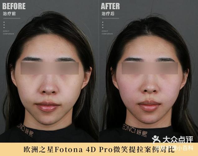 117前后