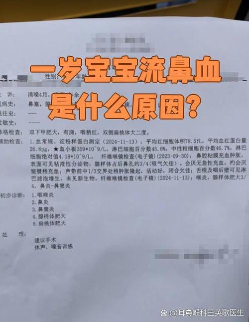 无征兆的流鼻血怎么回事
