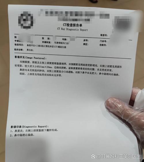 总是流鼻血是什么原因缩略图