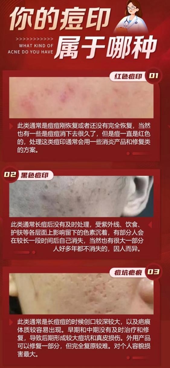 红色痘印消退的过程
