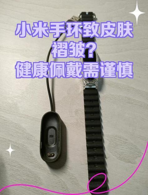 小米手环关注亲友对方能看到什么